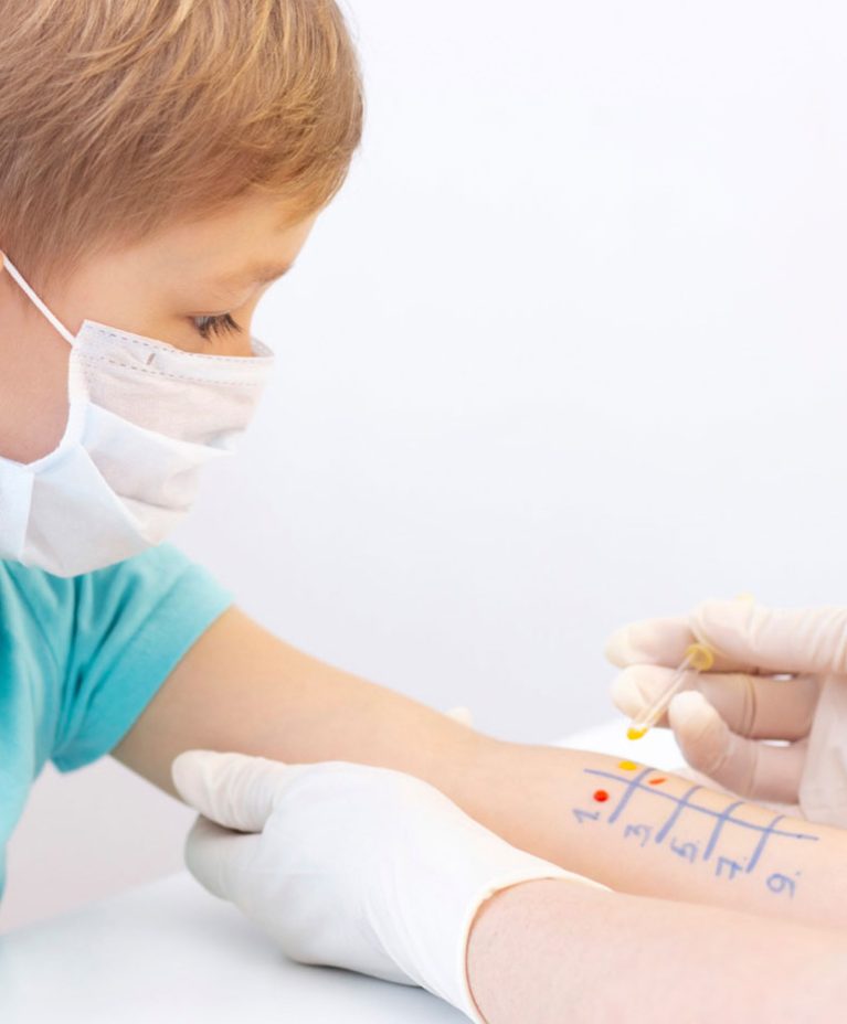 skin-prick-tests